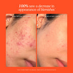 Tower 28 - SOS Skincare Minis Kit