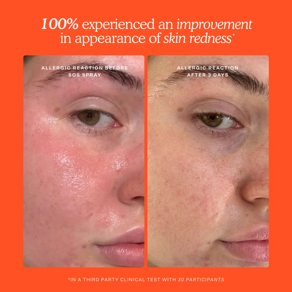 Tower 28 - SOS Skincare Minis Kit