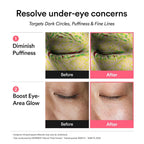 ABIB - PDRN Retinal Eye Patches