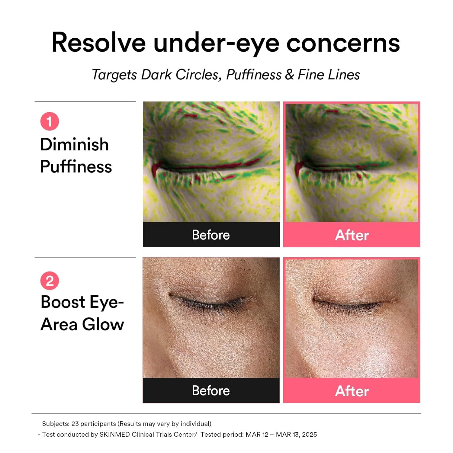 ABIB - PDRN Retinal Eye Patches