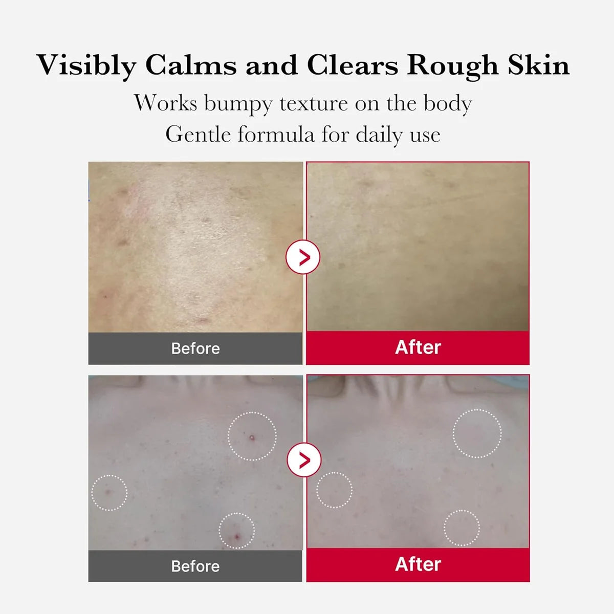 Medicube - Red Body Peeling Shot