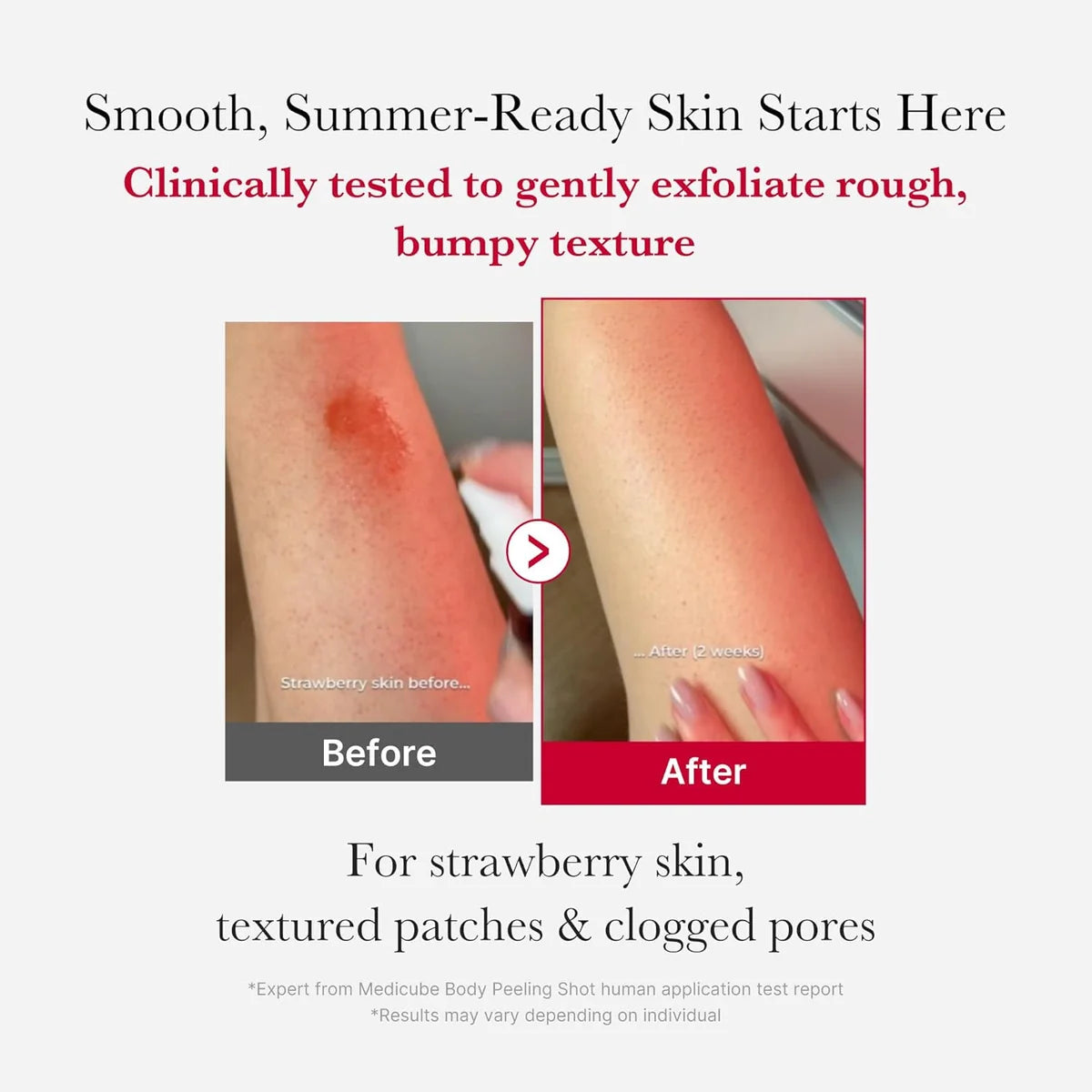 Medicube - Red Body Peeling Shot