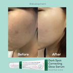 AXIS-Y: Dark Spot Correcting Glow Serum