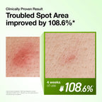 anua azelaic acid serum results
