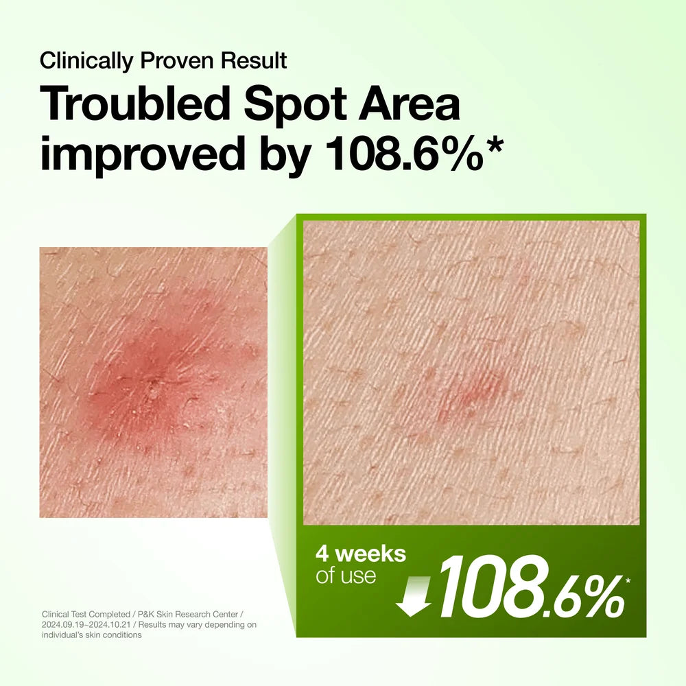 anua azelaic acid serum results