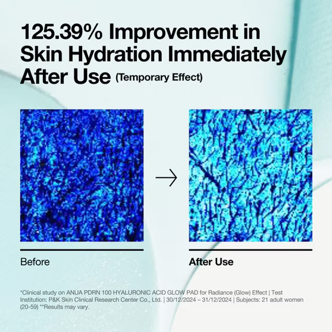 Anua - PDRN 100 Hyaluronic Acid Glow Pad