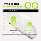 Anua - Ultra-Thin Spot Cover Patch