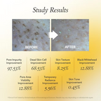 Aprilskin - Calendula Peel Off Mask - Beauty Station by Rafia