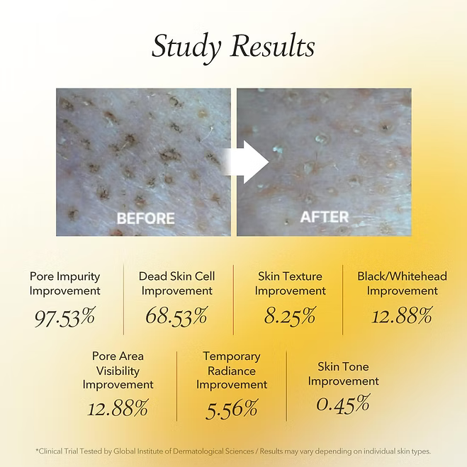 Aprilskin - Calendula Peel Off Mask - Beauty Station by Rafia