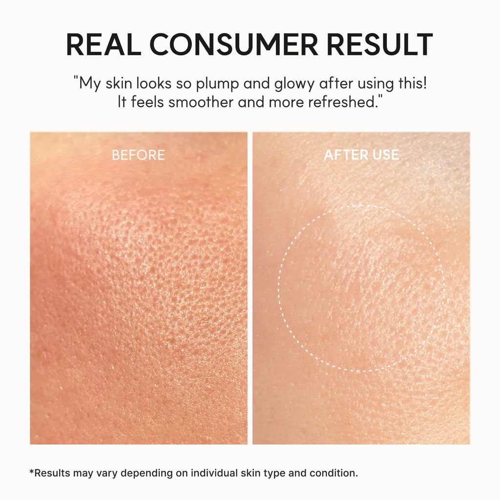 Arencia - NAD+ Time-Rewind Booster Shot Serum