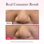 Arencia - Red Collagen Jello Mask (Single Sheet) - Beauty Station by Rafia