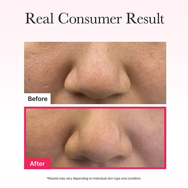 Arencia - Red Collagen Jello Mask (Single Sheet) - Beauty Station by Rafia