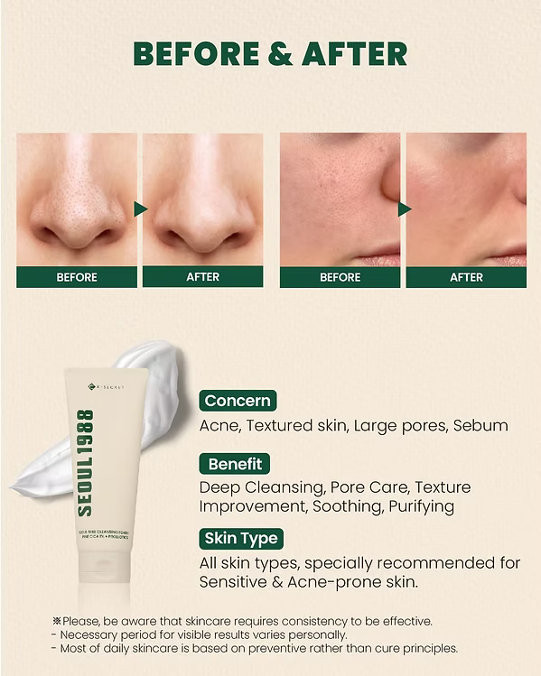 K-Secret - Seoul 1988 Cleansing Foam : Pine Cica 1% + Probiotics - Beauty Station by Rafia