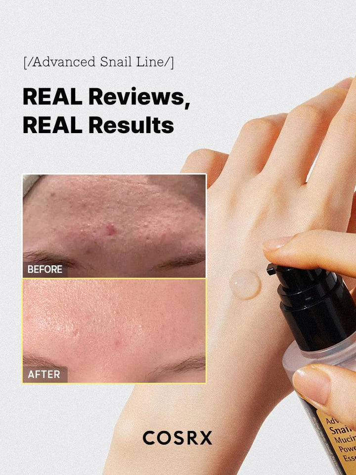 Cosrx - Advanced Snail 96 Mucin Power Essence - Beauty Station by Rafia