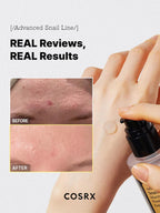 Cosrx - Advanced Snail 96 Mucin Power Essence - Beauty Station by Rafia