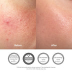 Dr. Althea 345 Relief Cream results and reviews