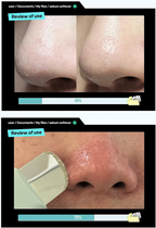 ILSO - Super Melting Sebum Softener - Beauty Station by Rafia