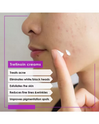 Jamjoom Pharma - Acretin 0.05% Cream For Acne Treatment - Beauty Station by Rafia