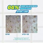 Jumiso - Blackhead Melting Softner - Beauty Station by Rafia