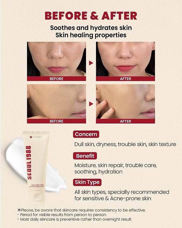 K-Secret - Seoul 1988 Cream : Snail Mucin 93% + Rice - Beauty Station by Rafia