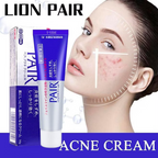 Lion - Pair Acne Cream W