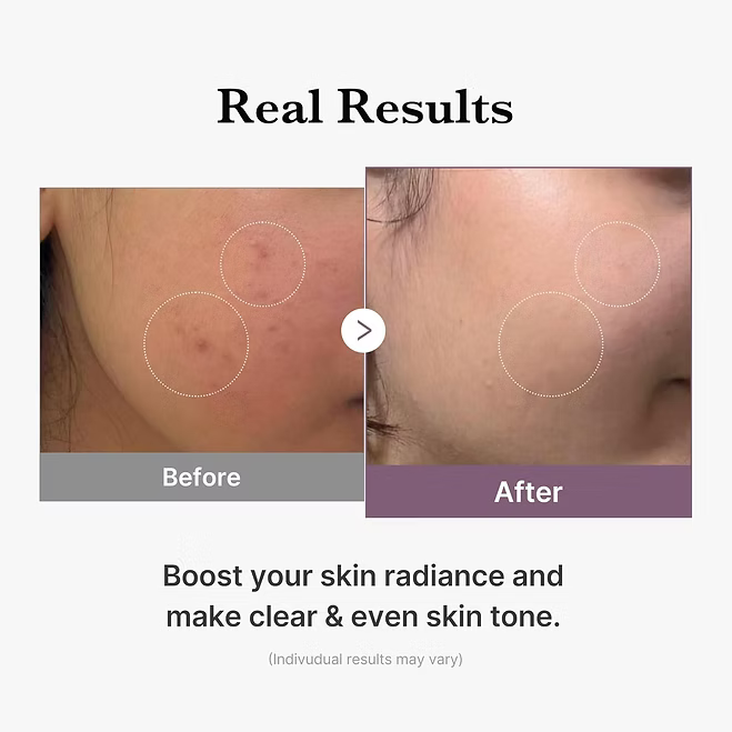 Medicube - Age-R Glutathione Glow Toner