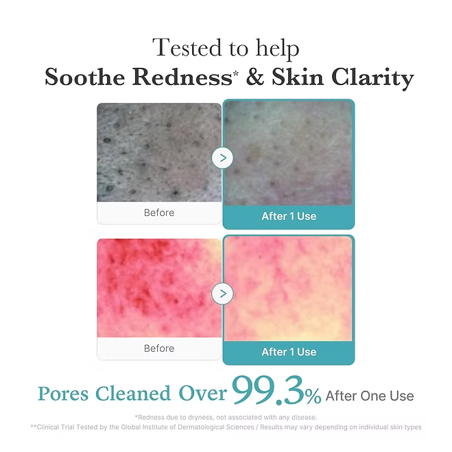 Medicube - Azelaic Acid Foam Cleanser - Beauty Station by Rafia