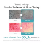 Medicube - Azelaic Acid Foam Cleanser - Beauty Station by Rafia