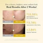 Medicube - Kojic Acid Turmeric Capsule Serum