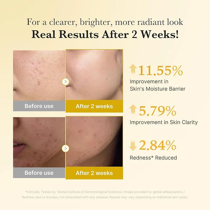 Medicube - Kojic Acid Turmeric Capsule Serum