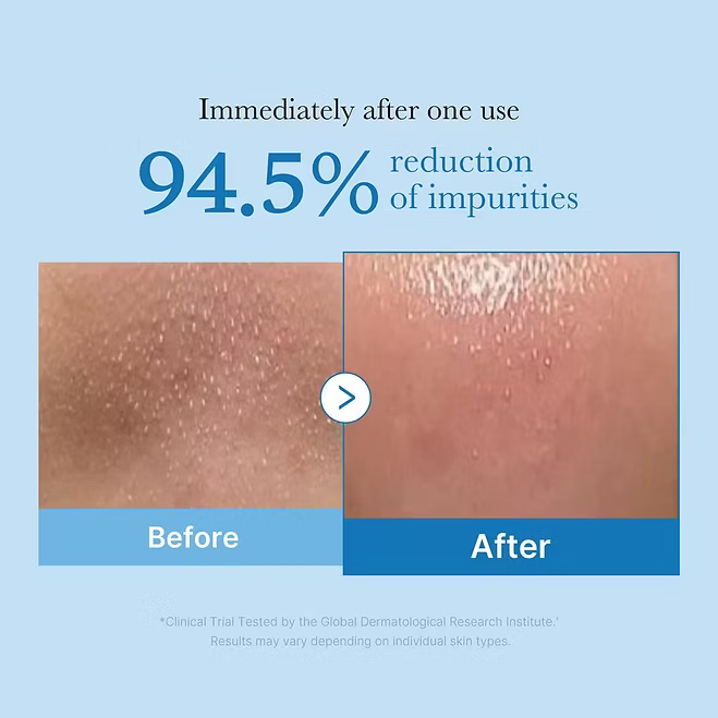 Medicube - Zero Pore Blackhead Deep Cleansing Oil - Beauty Station by Rafia