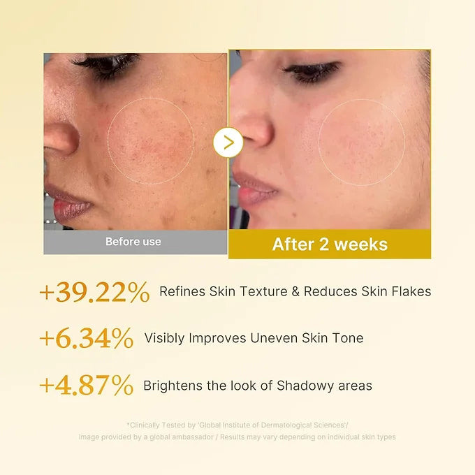 Medicube - Kojic Acid Turmeric Resurfacing Toner