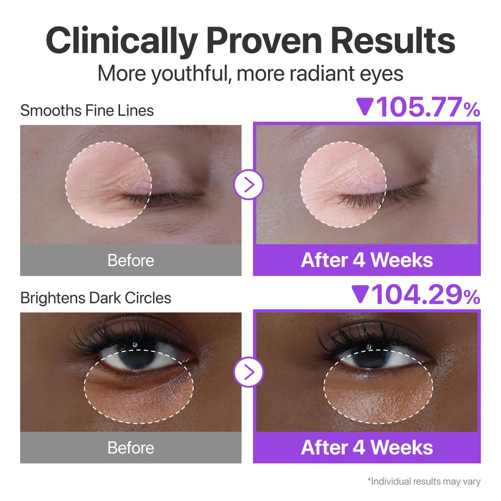 retinol eye cream in pakistan