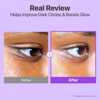 retinol eye cream for dark circles