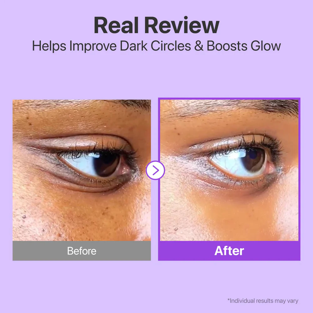 retinol eye cream for dark circles