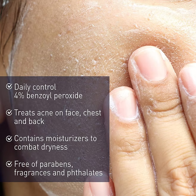 PanOxyl - Acne Creamy Face Wash With Benzoyl Peroxide 4% - Beauty Station by Rafia