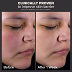 Paula's Choice - 2% BHA Liquid Exfoliant