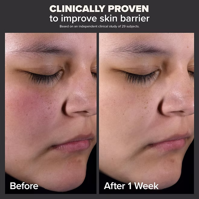 Paula's Choice - 2% BHA Liquid Exfoliant