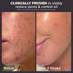 Paula's Choice - 2% BHA Liquid Exfoliant