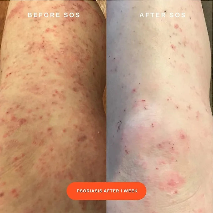 Tower 28 - SOS Rescue Facial Spray with Hypochlorous Acid