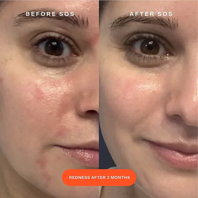 Tower 28 - SOS Rescue Facial Spray with Hypochlorous Acid