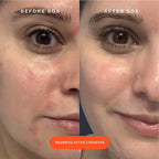 Tower 28 - SOS Rescue Facial Spray with Hypochlorous Acid