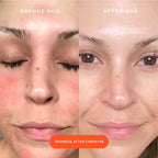 Tower 28 - SOS Rescue Facial Spray with Hypochlorous Acid