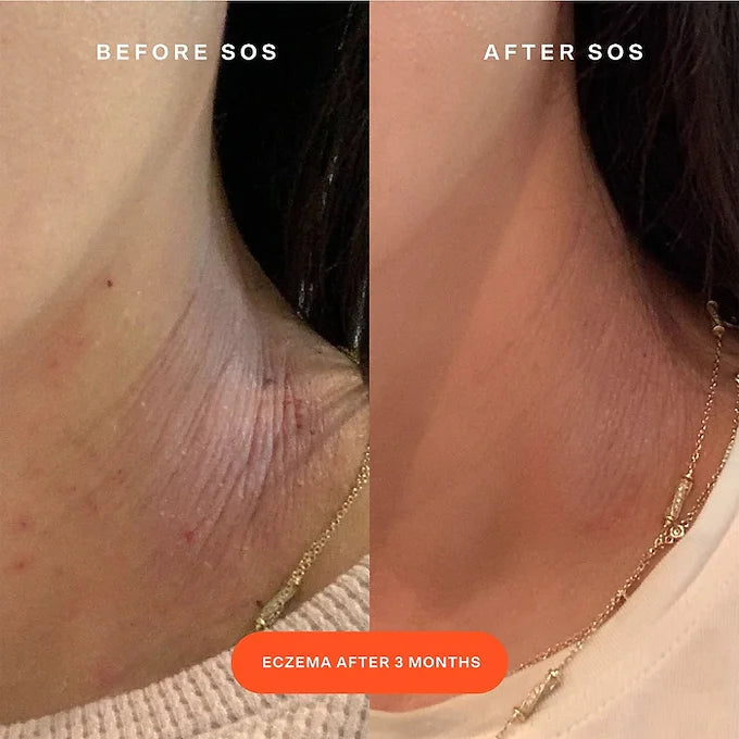 Tower 28 - SOS Rescue Facial Spray with Hypochlorous Acid