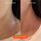 Tower 28 - SOS Rescue Facial Spray with Hypochlorous Acid