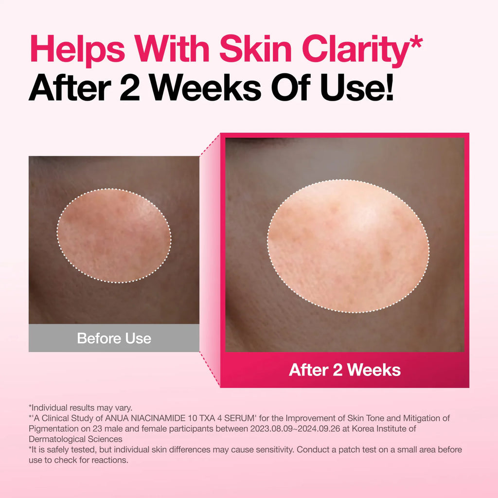 anua niacinamide 10 + txa 4 dark spot correcting serum