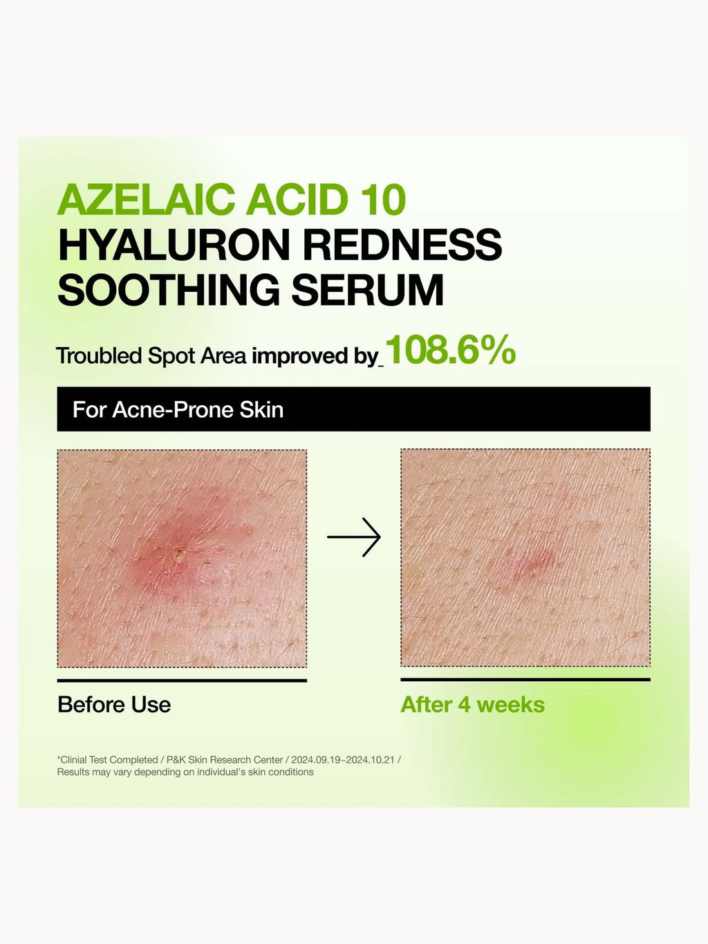 Anua - Kpop Demon Hunters Calming Skin Discovery Set